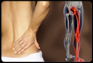 sciatica-s2-photo-of-lower-back-pain